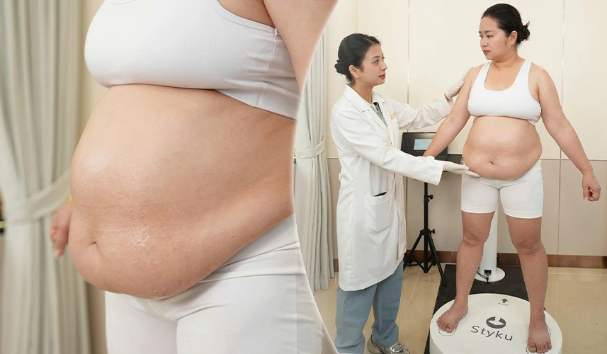 Ảnh hưởng do béo phì không giảm mỡ sẽ ảnh hưởng đến sức khỏe toàn thân