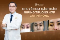 Chuyên gia cảnh báo những trường hợp cắt mí hỏng?