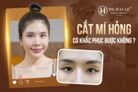 Cắt mí mắt hỏng có sửa được không
