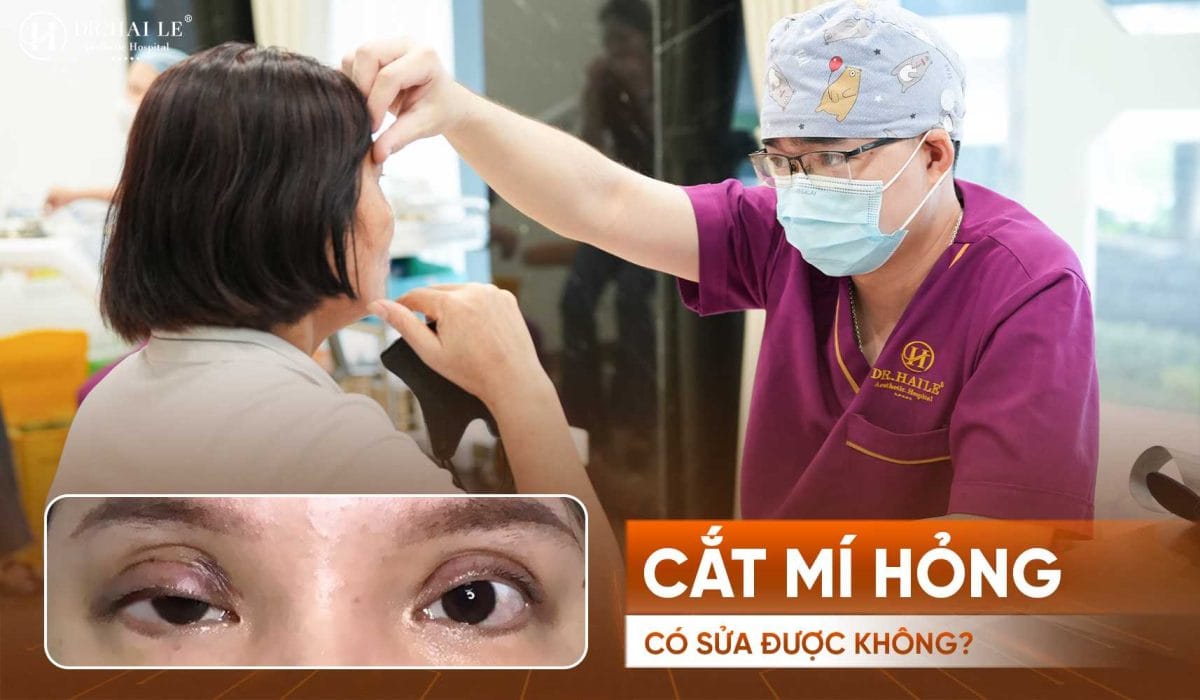 Chuyên gia sửa mí mắt Dr.Hải Lê? 5 Cắt mí hỏng có sửa được không lời giải đáp từ chuyên gia