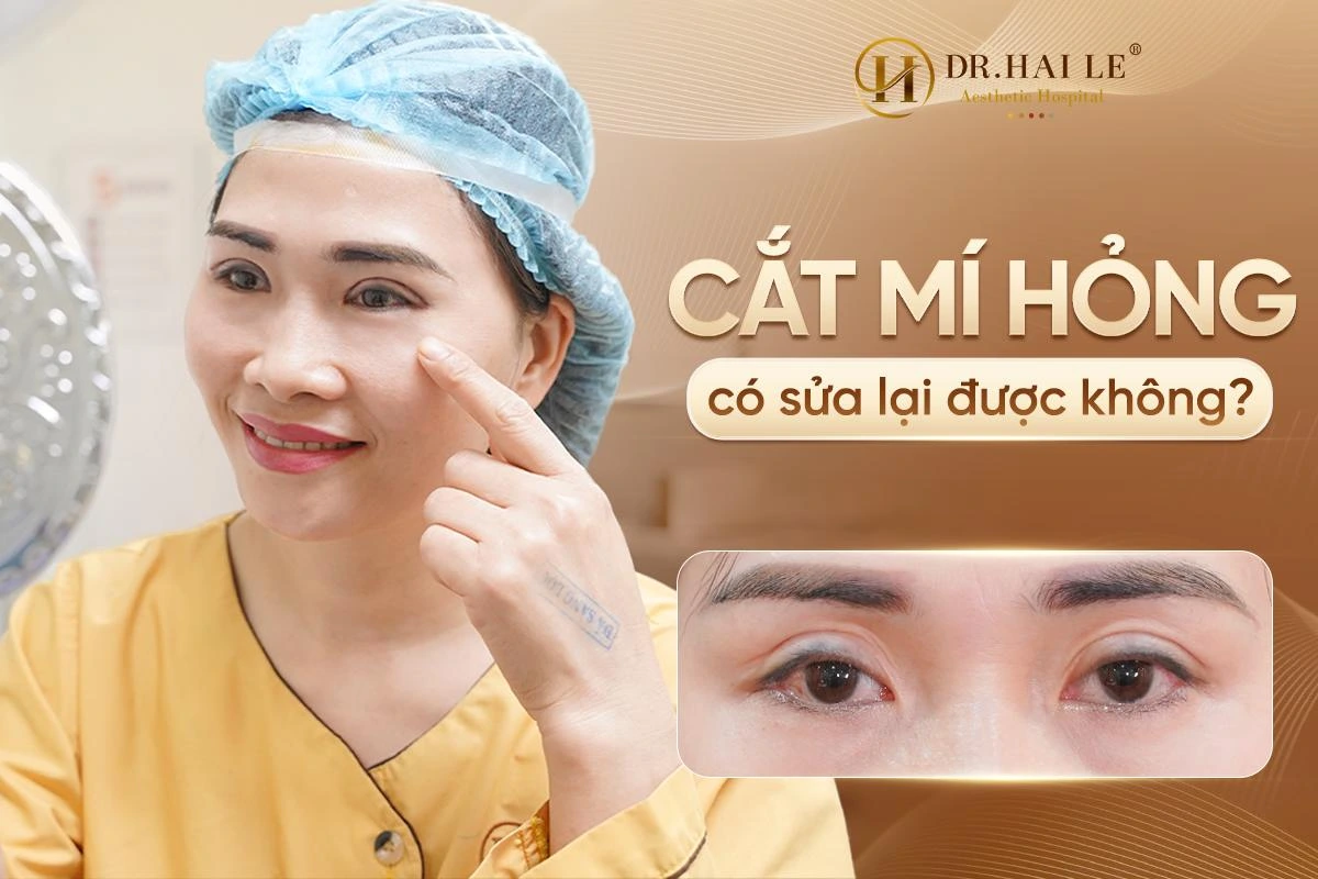 cắt mí bị hỏng có sửa được không