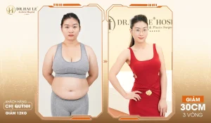 Tổ Hợp công nghệ Lipomed giảm mỡ và kiểm soát cân nặng hiệu quả an toàn chuẩn y khoa