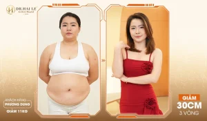 Lipomed kiểm soát cân nặng và giảm mỡ trở lại vóc dáng