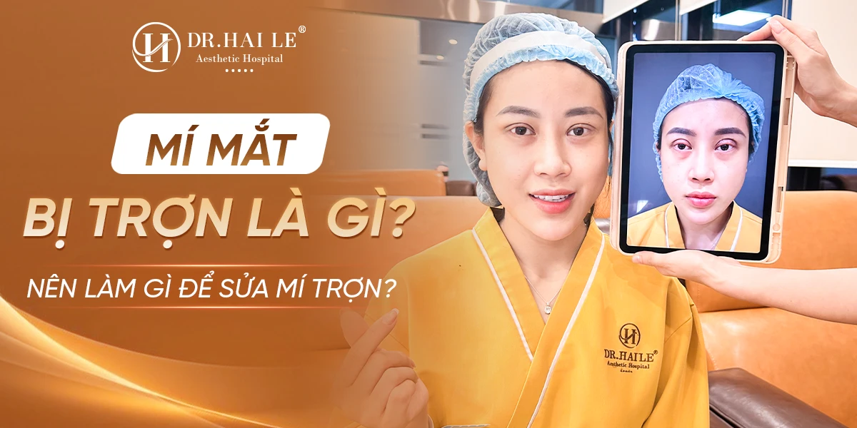 Mí mắt bị trợn là gì? Nên làm gì để sửa mí trợn?
