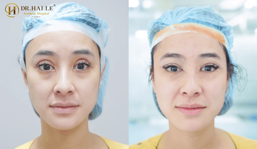 Chúng tôi cam kết mang đến phác đồ điều trị cá nhân hóa, chạm chuẩn an toàn y khoa, tận tâm đồng hành
