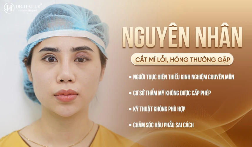 Nguyên nhân gây ra biến chứng mí hỏng do cơ sở thiếu uy tín