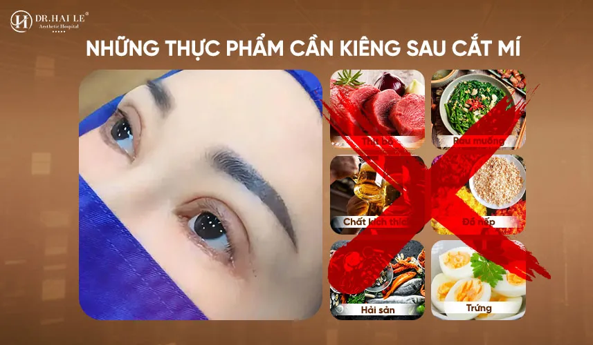 nhung thuc pham can kieng sau cat mi 1