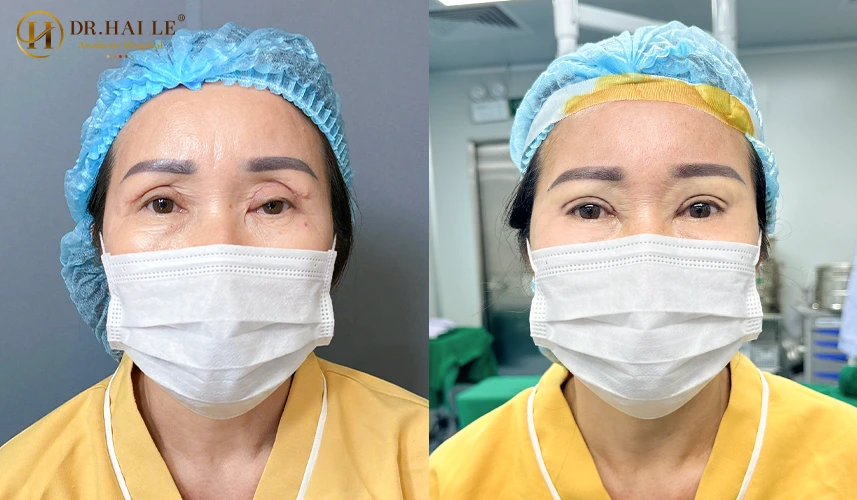 Với hệ thống phòng mổ vô khuẩn khép kín, đội ngũ thạc sĩ, bác sĩ chuyên khoa giỏi chuyên môn cùng phác đồ điều trị cá nhân