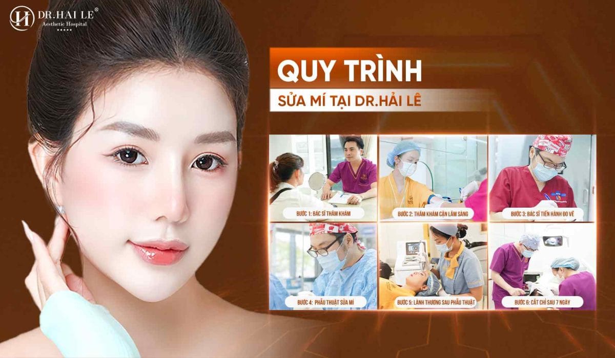 Chuyên gia sửa mí mắt Dr.Hải Lê? 6 Quy trình sửa mí chuẩn y khoa tại Dr.Hải Lê