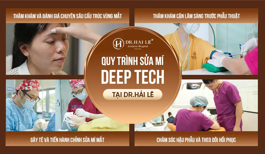 Quy trình sửa mí