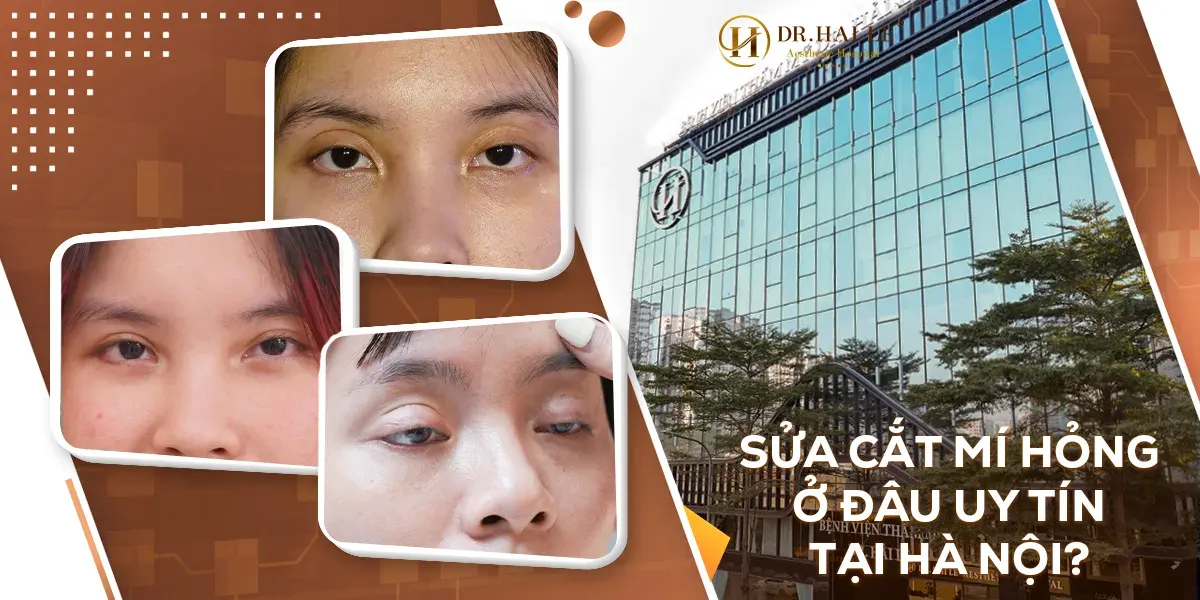 Sửa cắt mí hỏng ở đâu uy tín tại Hà Nội?