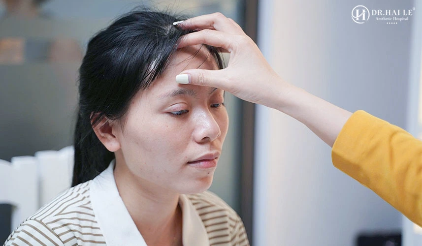 Tại sao nên sửa cắt mí mắt hỏng bệnh viện thẩm mỹ Dr.Hải Lê 3 Sửa cắt mí mắt hỏng sau phẫu thuật yêu cầu bác sĩ có kinh nghiệm chuyên sâu trong phẫu thuật tạo hình mí mắt