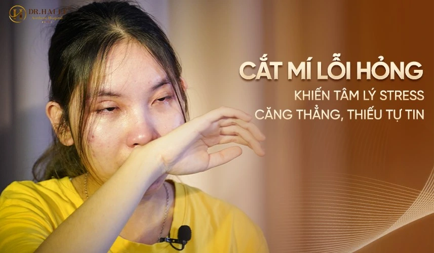 Cắt mí bị hỏng khiến hàng nghìn khách hàng rơi vào trạng thái hoang mang, khủng hoảng tâm lý và mất tự tin nghiêm trọng.