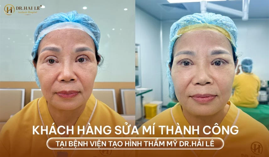 Dr.Hải Lê luôn đặt tiêu chuẩn an toàn y khoa lên hàng đầu. Quy trình can thiệp được thiết kế như một quy chuẩn SOP (Standard Operating Procedure) nghiêm ngặt
