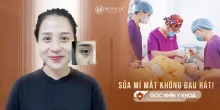 Sửa mí mắt không đau rát?