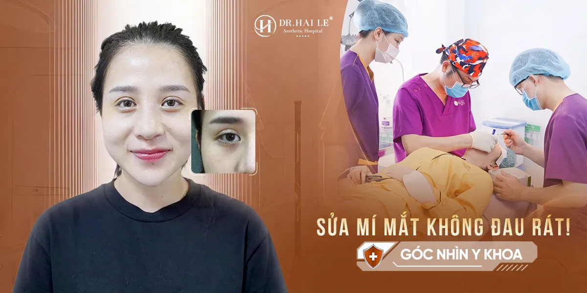 Sửa mí mắt không đau rát?