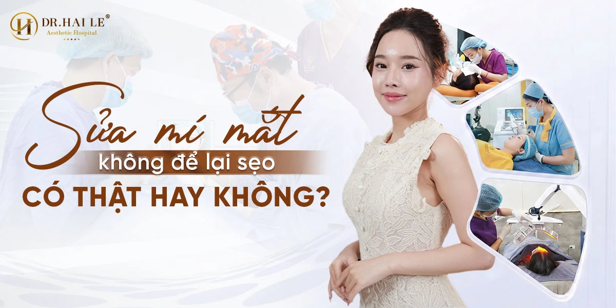 Sửa mí mắt không để lại sẹo an toàn và hiệu quả?