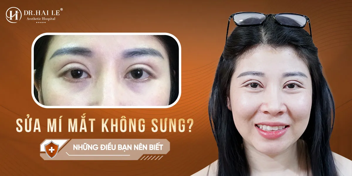 Sửa mí mắt không sưng bí quyết cho đôi mắt đẹp tự nhiên?