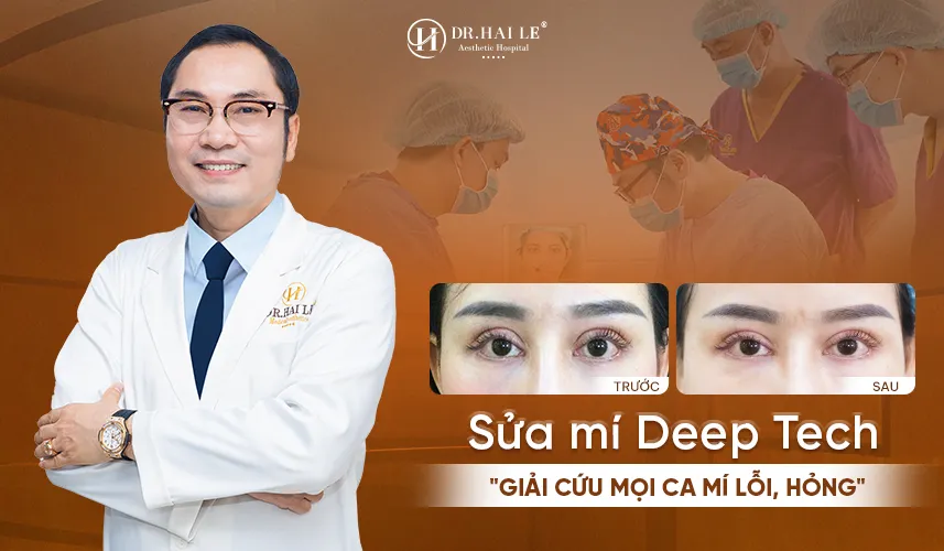 Các kỹ thuật sửa mí hỏng độc quyền tại Dr.Hải Lê