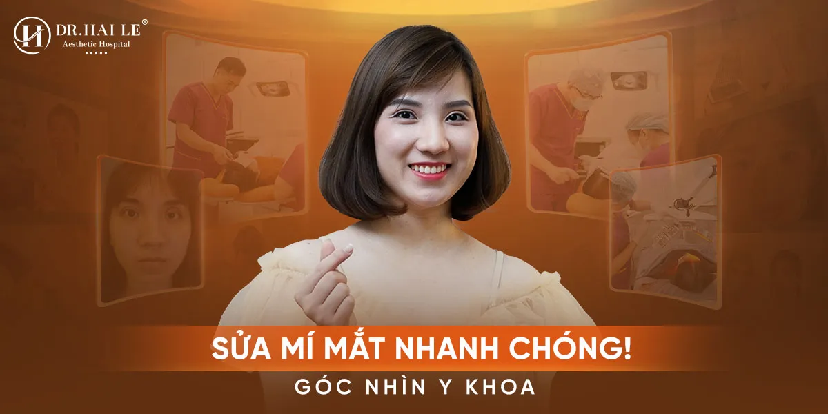 Sửa mí mắt nhanh chóng - Nâng tầm nhan sắc, tự tin tỏa sáng