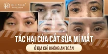 Tác hại của cắt sửa mí mắt ở địa chỉ không an toàn?