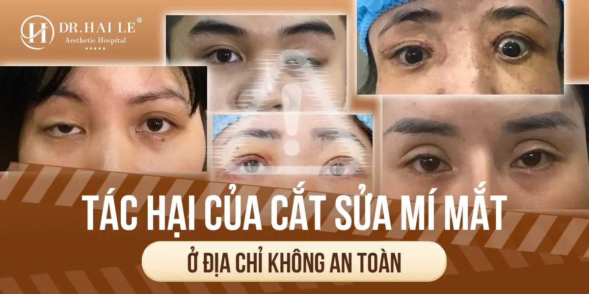 Tác hại của cắt sửa mí mắt ở địa chỉ không an toàn?