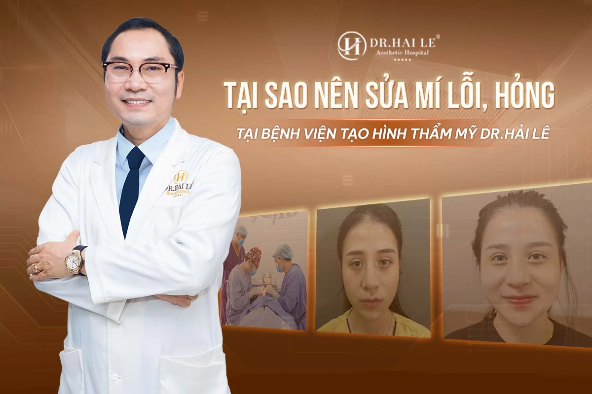 Tại sao nên sửa cắt mí mắt hỏng bệnh viện thẩm mỹ Dr.Hải Lê 1 tai sao nen sua mi loi hong dr hai le 1