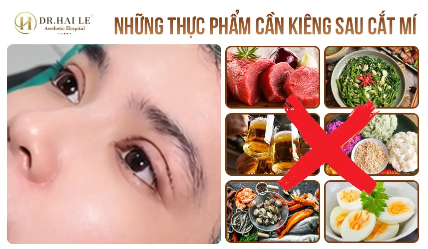 nhung thuc pham can kieng sau phau thuat cat mi 1