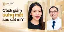 Cách giảm sưng mắt sau cắt mí?