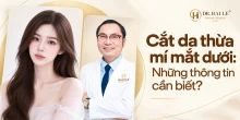 Cắt da thừa mí mắt dưới: Những thông tin cần biết?