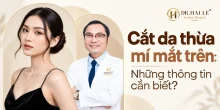 Cắt da thừa mí mắt trên: Những thông tin cần biết?