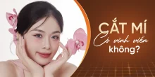 Cắt mí có vĩnh viễn không?