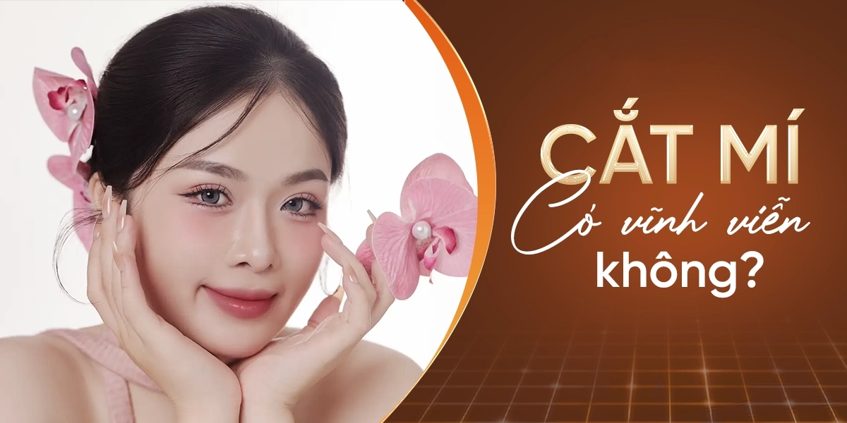 Cắt mí có vĩnh viễn không?