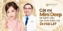 Cắt mí Mini Deep tại bệnh viện tạo hình thẩm mỹ Dr.Hải Lê?