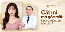Cắt mí mở góc mắt: Những thông tin cần biết?