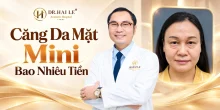 Căng da mặt mini bao nhiêu tiền?