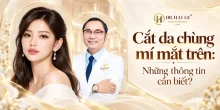 Cắt da chùng mí mắt trên: Những thông tin cần biết?