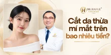Cắt da thừa mí mắt trên bao nhiêu tiền?