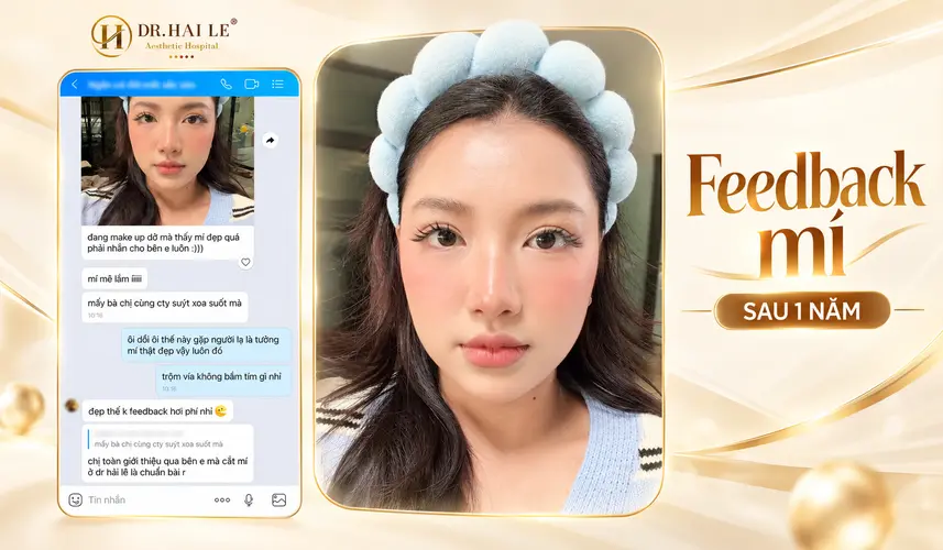 Hình ảnh đôi mắt và tin nhắn phản hồi của khách hàng sau cắt mí 1 năm tại Dr. Hải Lê.