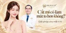 Cắt mí có làm mắt to hơn không? Giải pháp cho mắt ti hí