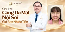 Chi phí căng da mặt nội soi giá bao nhiêu tiền?