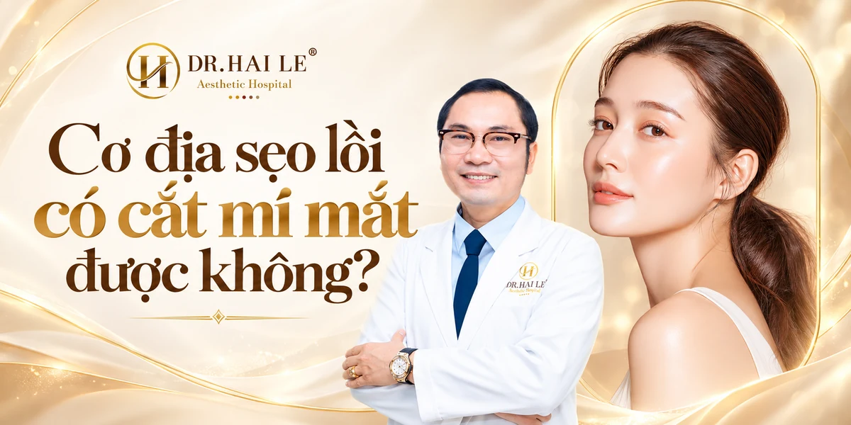 Cơ địa sẹo lồi có cắt mí mắt được không?