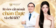 Review cắt mí mắt chân thực và chi tiết?