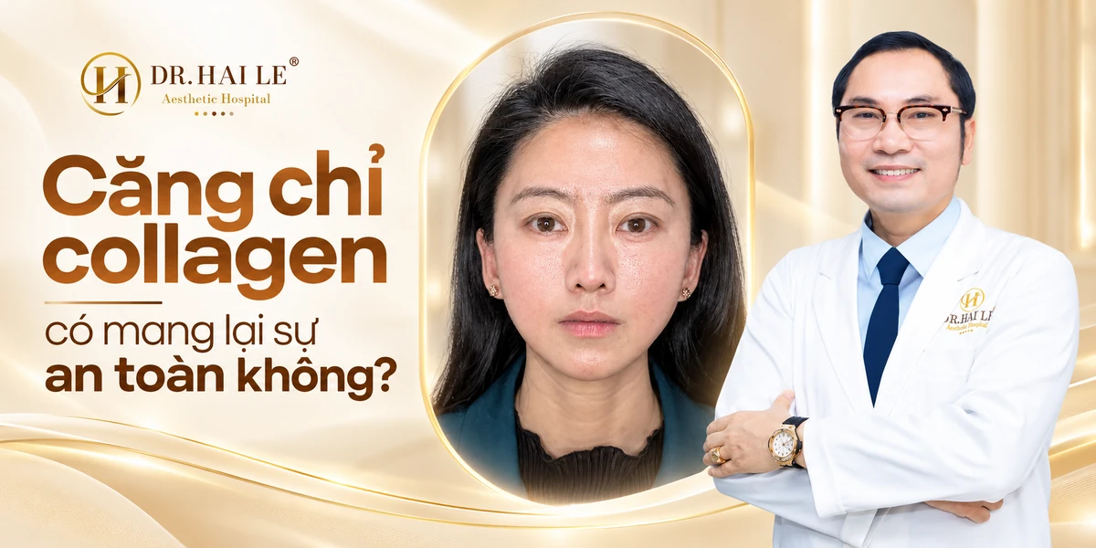 Căng chỉ collagen có mang lại sự an toàn không?