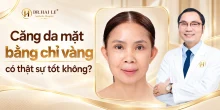 Căng da mặt bằng chỉ vàng có thật sự tốt không?